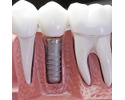 Ghauri Dental Centre